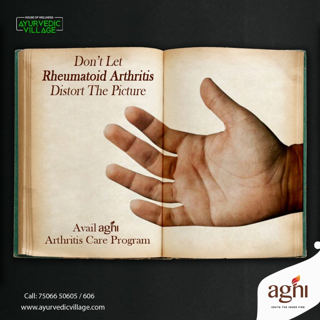 rheumatoid arthritis