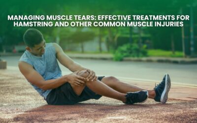 Managing Muscle Tears: Effective Treatments for Hamstring and Other Common Muscle Injuries