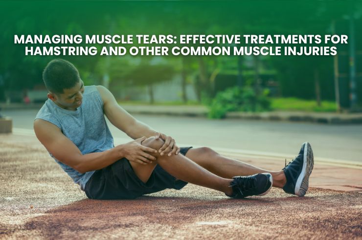 Managing Muscle Tears: Effective Treatments for Hamstring and Other Common Muscle Injuries