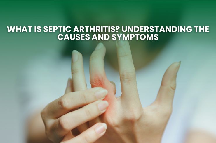 What is Septic Arthritis? Understanding the Causes and Symptoms