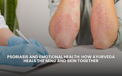 Psoriasis and Emotional Health: How Ayurveda Heals the Mind and Skin Together