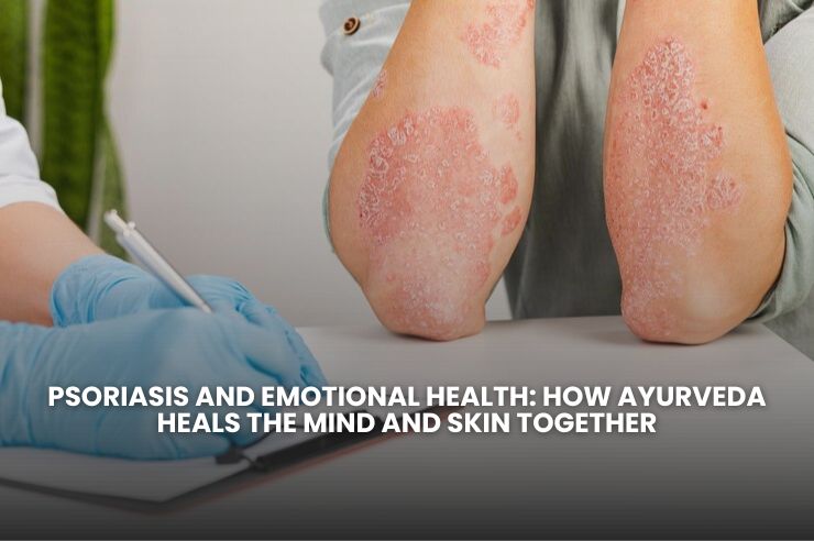 Psoriasis and Emotional Health: How Ayurveda Heals the Mind and Skin Together