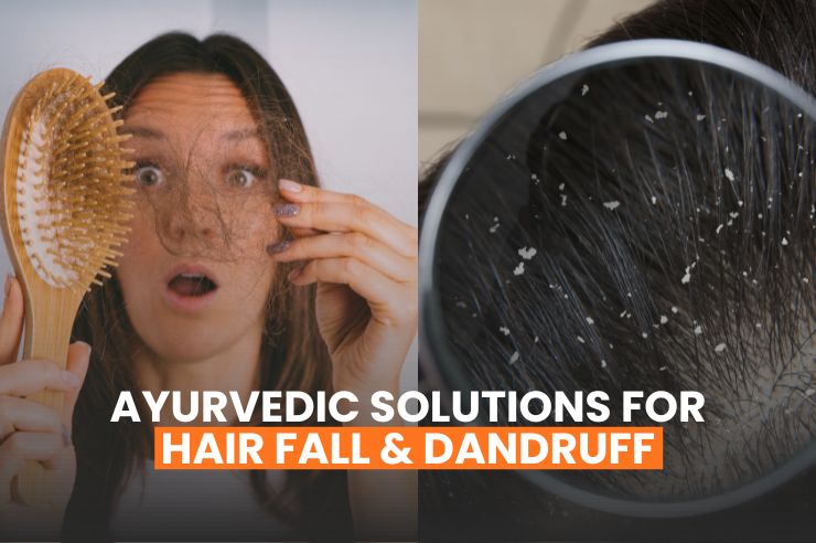 Ayurvedic Solutions For Hair Fall & Dandruff
