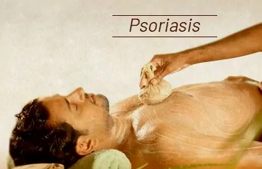 Psoriasis-Treatment